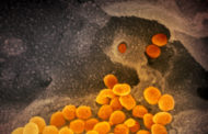 Coronavirus, funzionano gli anticorpi del vaccino italiano