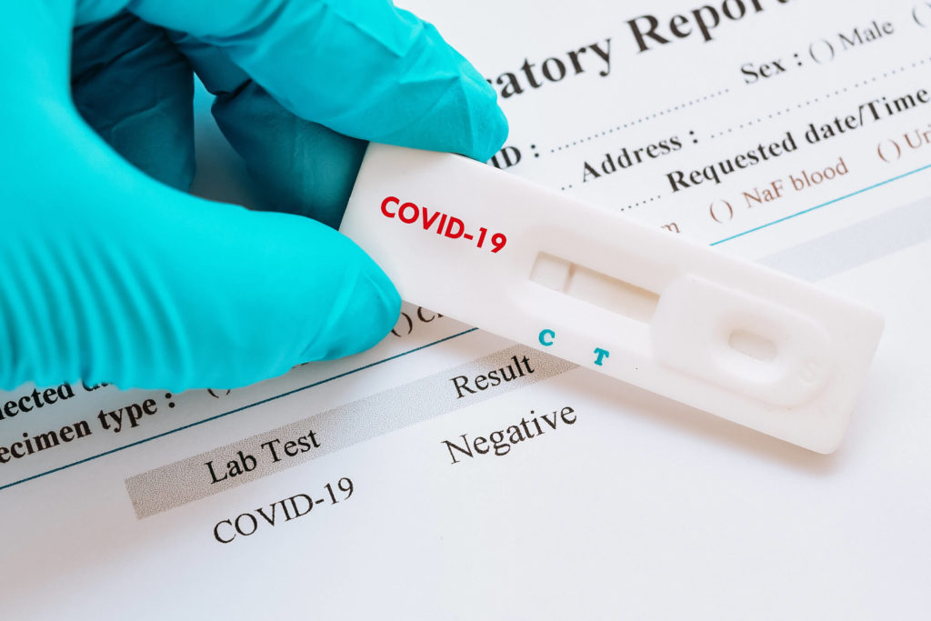 Coronavirus, sabato 16 e domenica 17 gennaio 2021 tamponi rapidi a studenti elementari e medie in provincia di Trapani